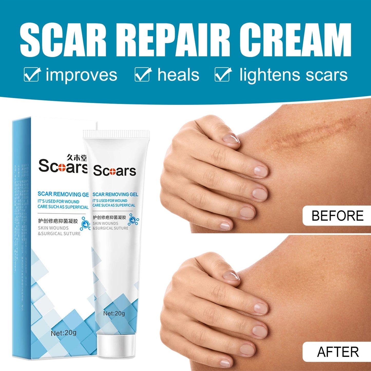 New Herbal Scar Repair Cream